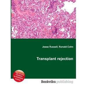  Transplant rejection Ronald Cohn Jesse Russell Books