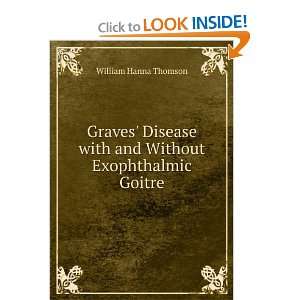  Graves Disease with and Without Exophthalmic Goitre 