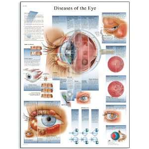  VR0231UU Glossy Paper Erkrankungen Des Auges Anatomical Chart 